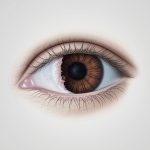 gangguan penglihatan