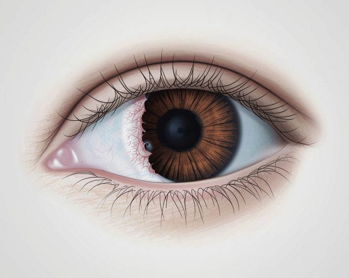 gangguan penglihatan